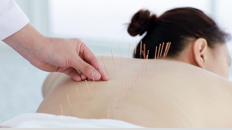 artigo-acupuntura-e-seus-benefícios-na-qualidade-de-vida