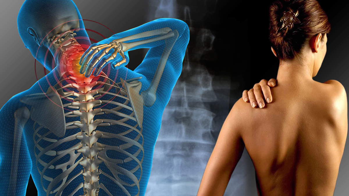 Fibromialgia Dr. Carlos Romeu